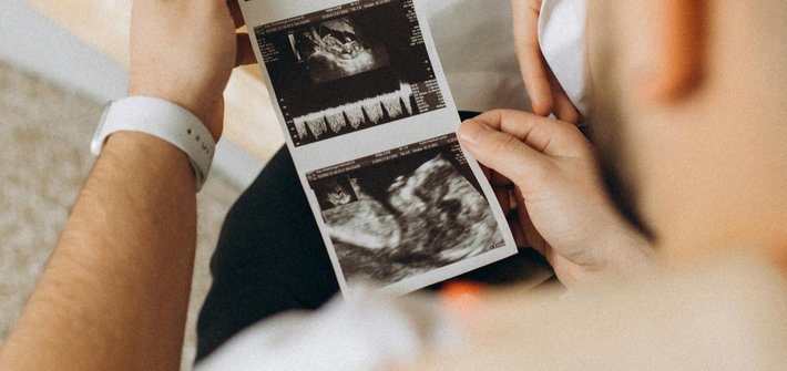 image of a man holding an ultrasound printout of baby with partner's arm around his shoulder