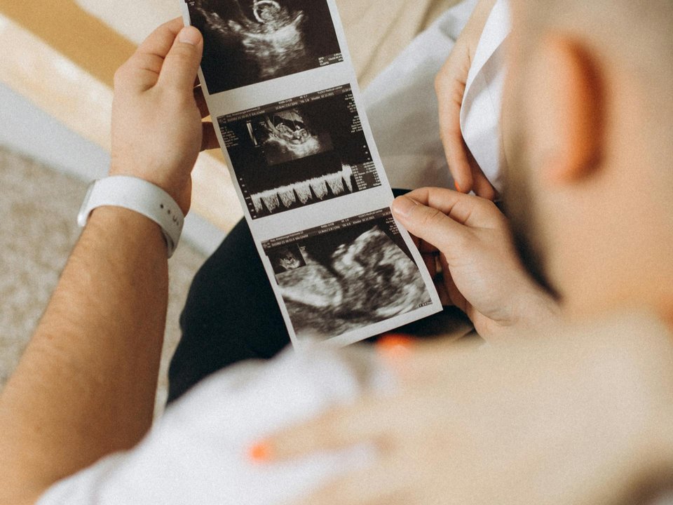 image of a man holding an ultrasound printout of baby with partner's arm around his shoulder