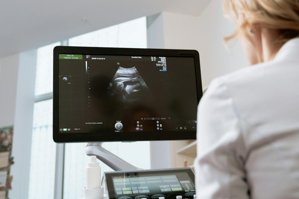 woman looking at the screen for a sonography