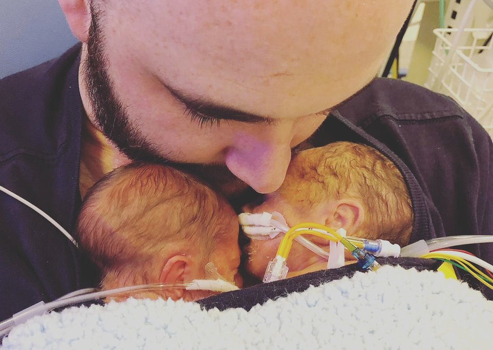 A close up of a man's head dipped towards two premature babies held to his chest