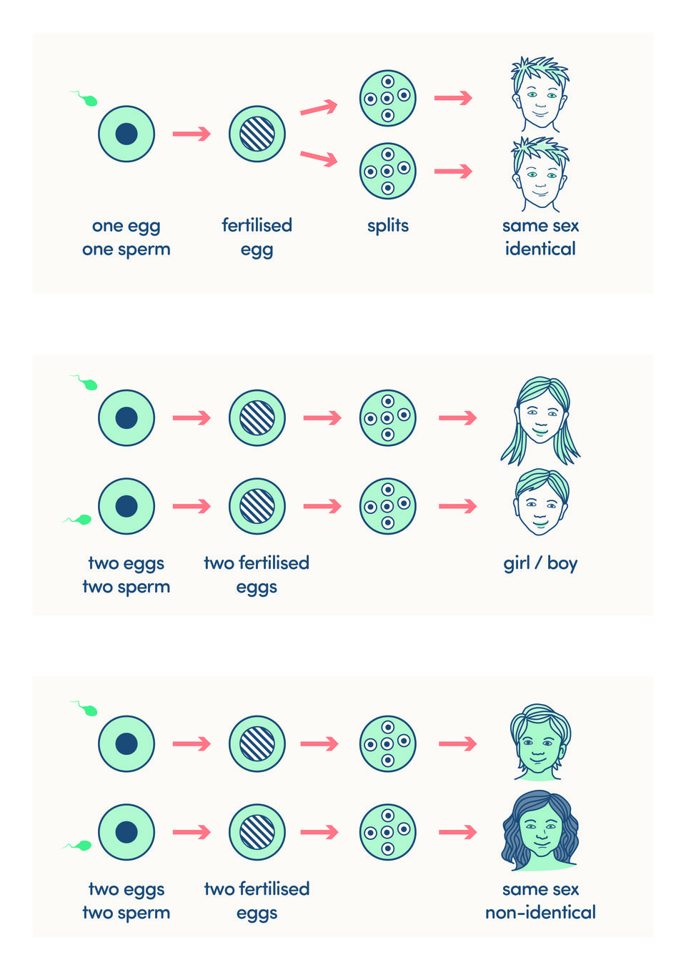 diagram illustrating different types of twin pregnancies
