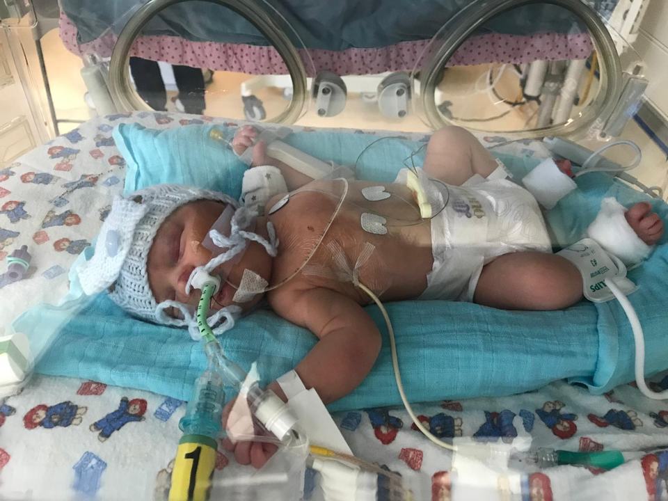 a baby in an incubator receiving neonatal care
