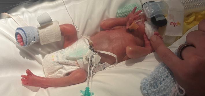 a mother's finger touching a baby's hand in neonatal intensive care