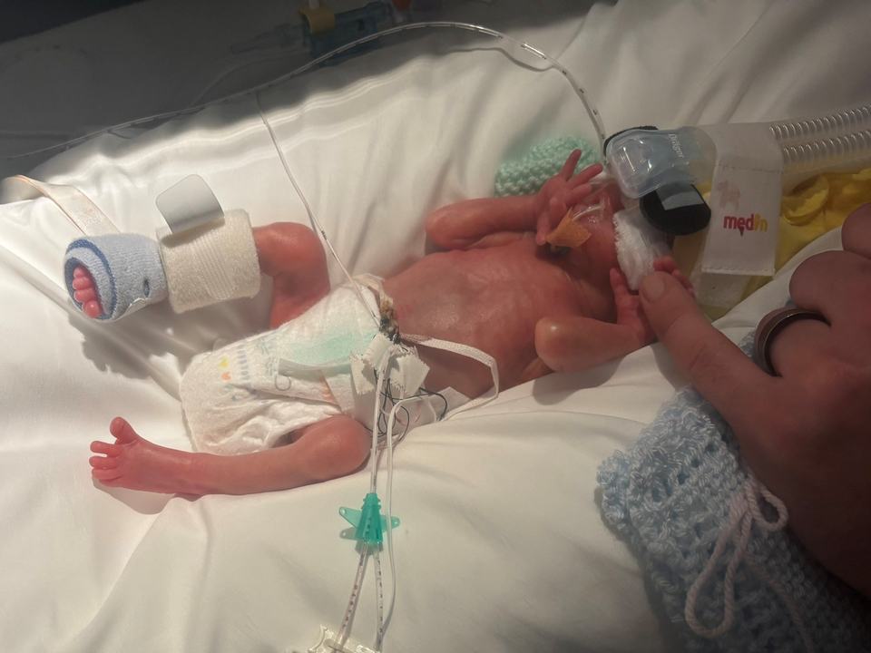 a mother's finger touching a baby's hand in neonatal intensive care